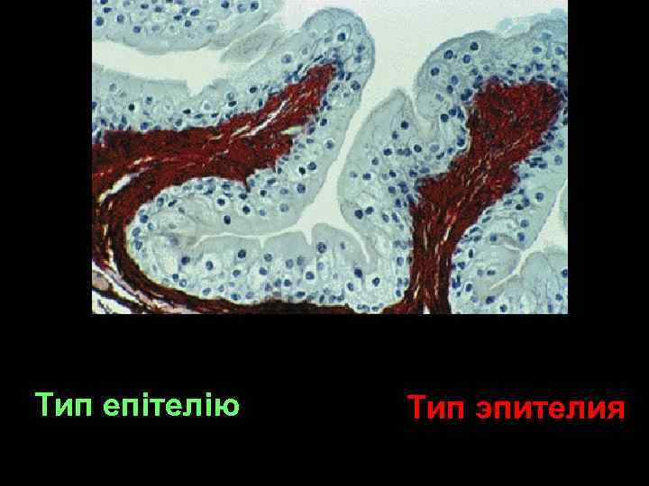 Тип епітелію Тип эпителия 