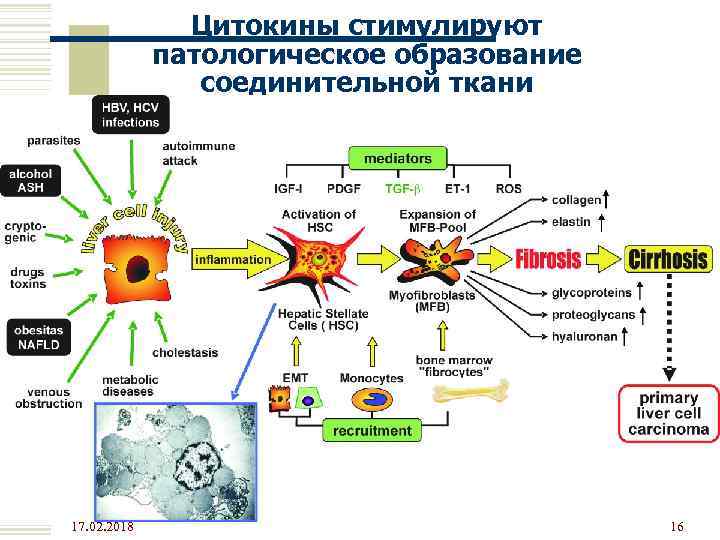 Цитокины стимулируют патологическое образование соединительной ткани 17. 02. 2018 16 