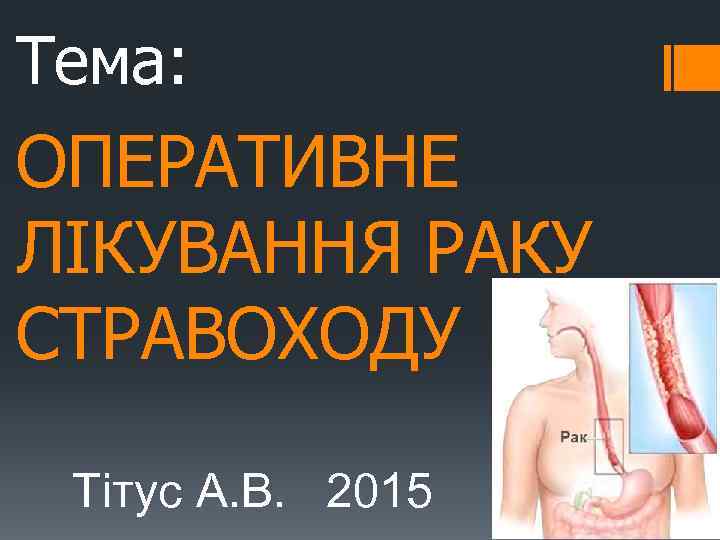 Тема: ОПЕРАТИВНЕ ЛІКУВАННЯ РАКУ СТРАВОХОДУ Тітус А. В. 2015 