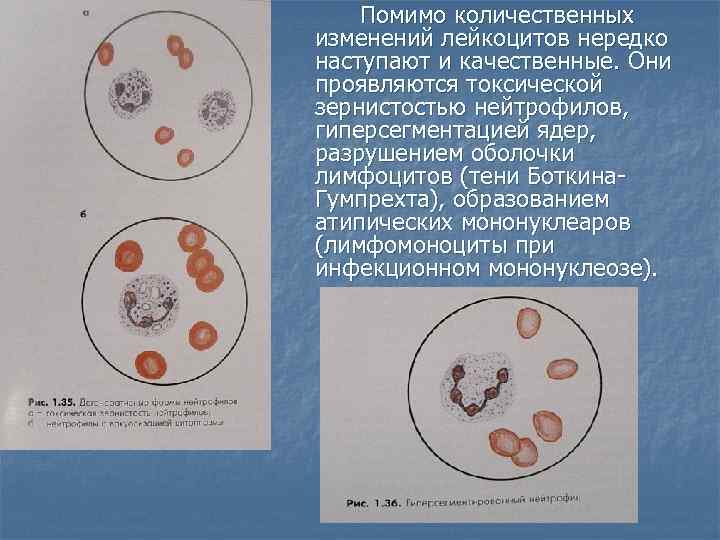 Реактивные изменения лейкоцитов