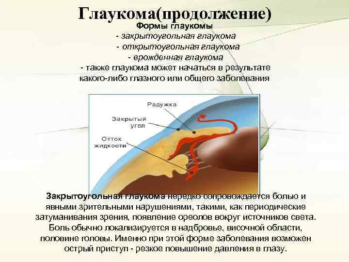 Закрытоугольная глаукома клинические рекомендации. Открытоугольная и закрытоугольная глаукома. Закрытоугольная глаукома патогенез. Открытоугольная глаукома препараты. Закрытоугольная глаукома ток жидкости.