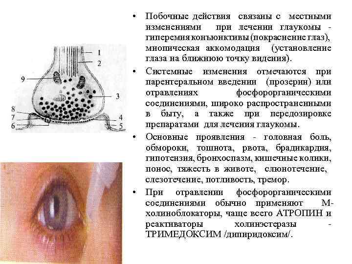  • Побочные действия связаны с местными изменениями при лечении глаукомы гиперемия конъюнктивы (покраснение
