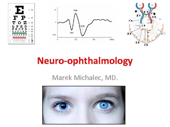 Neuro-ophthalmology Marek Michalec, MD. 