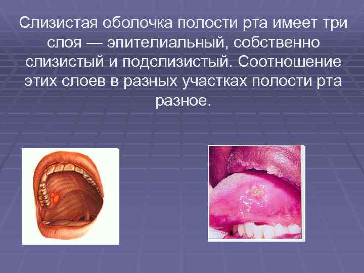 Слизистая оболочка полости рта имеет три слоя — эпителиальный, собственно слизистый и подслизистый. Соотношение