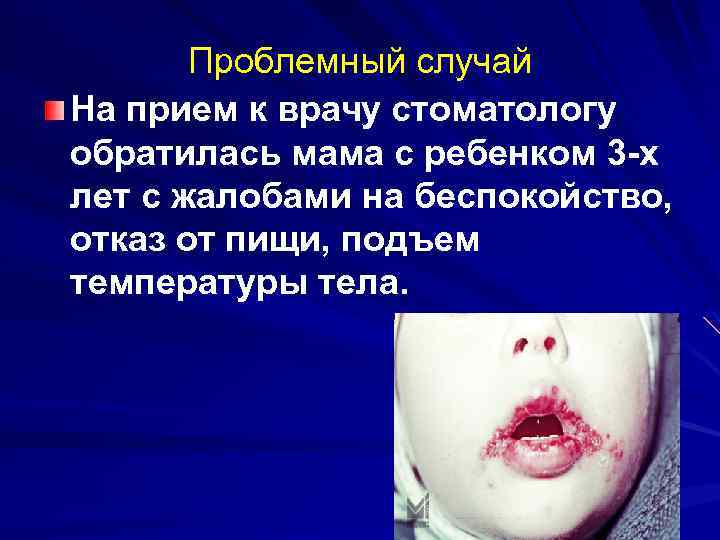 Проблемный случай На прием к врачу стоматологу обратилась мама с ребенком 3 -х лет