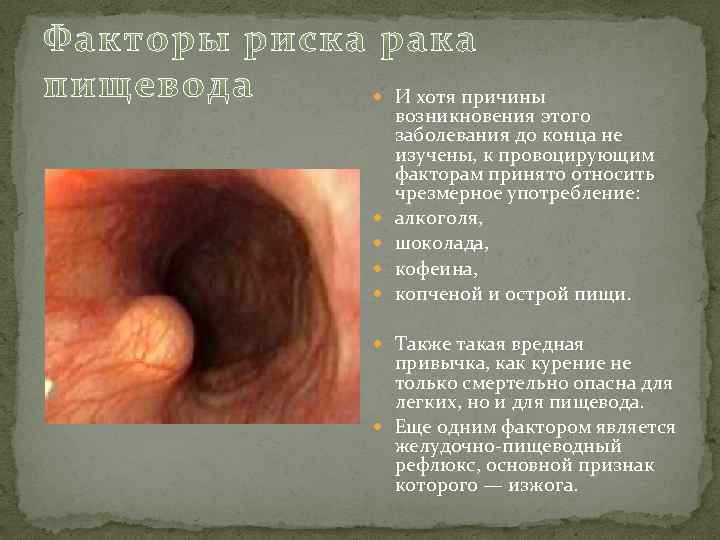  И хотя причины возникновения этого заболевания до конца не изучены, к провоцирующим факторам