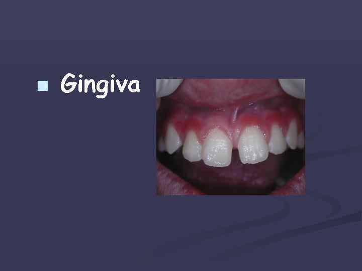 n Gingiva 