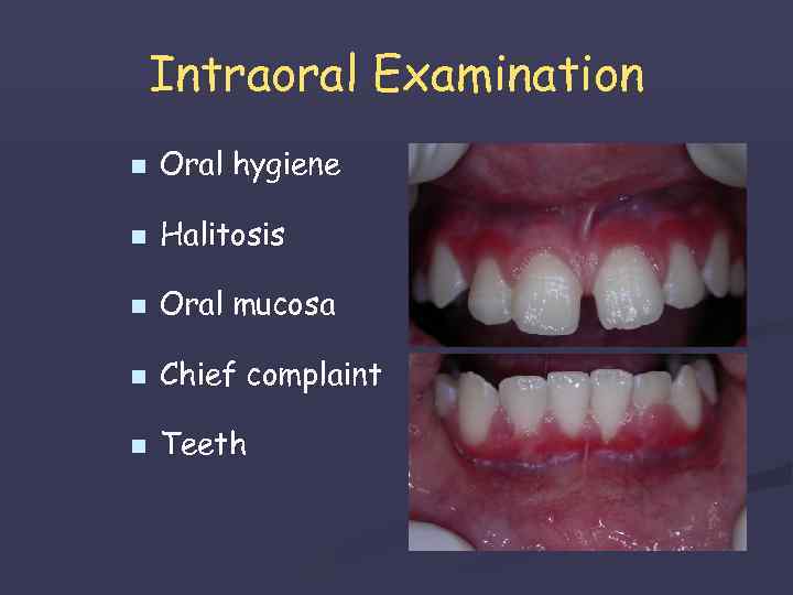 Intraoral Examination n Oral hygiene n Halitosis n Oral mucosa n Chief complaint n