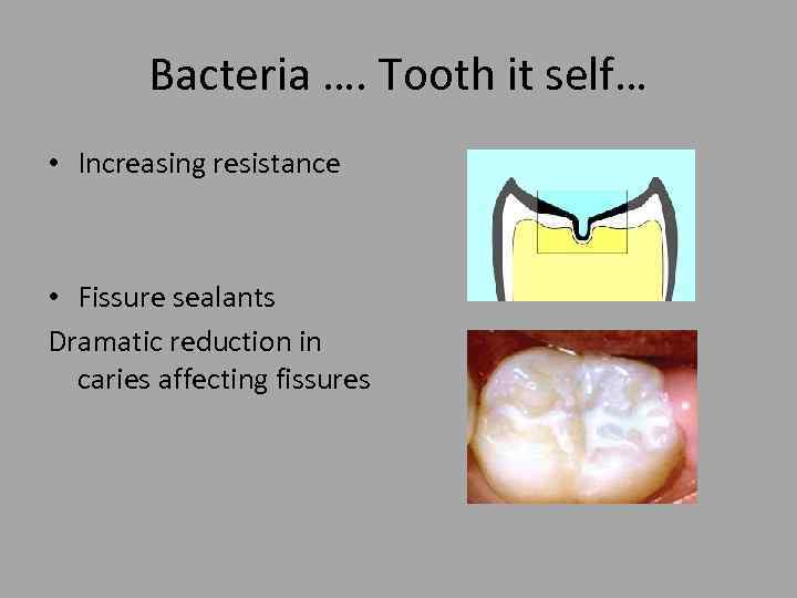 Bacteria …. Tooth it self… • Increasing resistance • Fissure sealants Dramatic reduction in