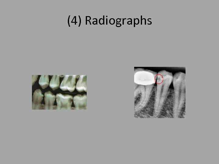 (4) Radiographs 