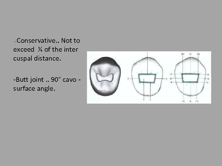 Conservative. . Not to exceed ¼ of the inter cuspal distance. - -Butt joint.