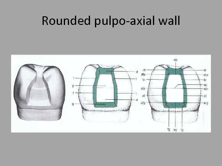 Rounded pulpo-axial wall 