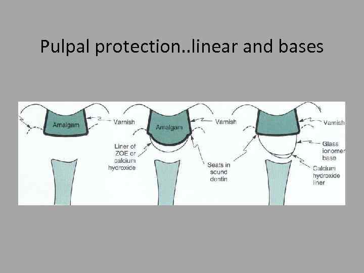 Pulpal protection. . linear and bases 