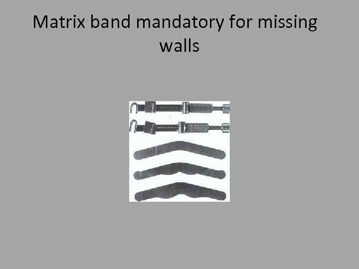 Matrix band mandatory for missing walls 