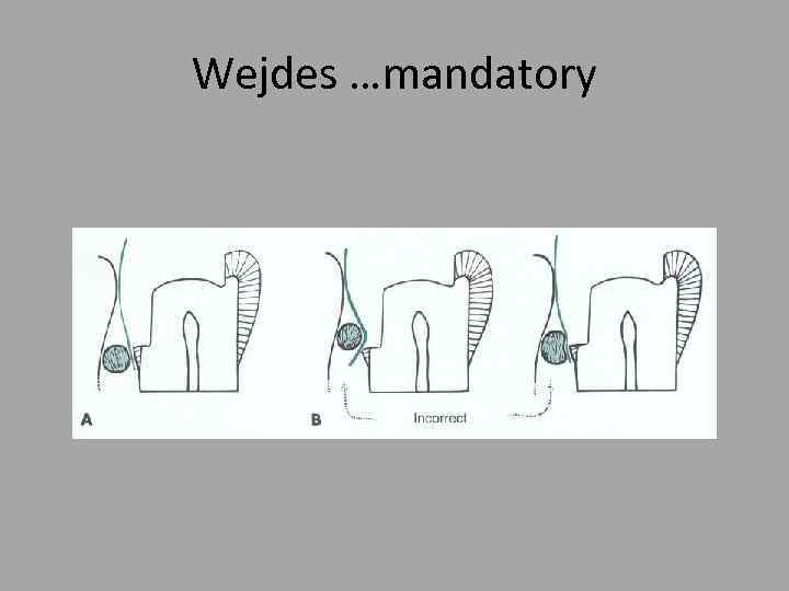 Wejdes …mandatory 