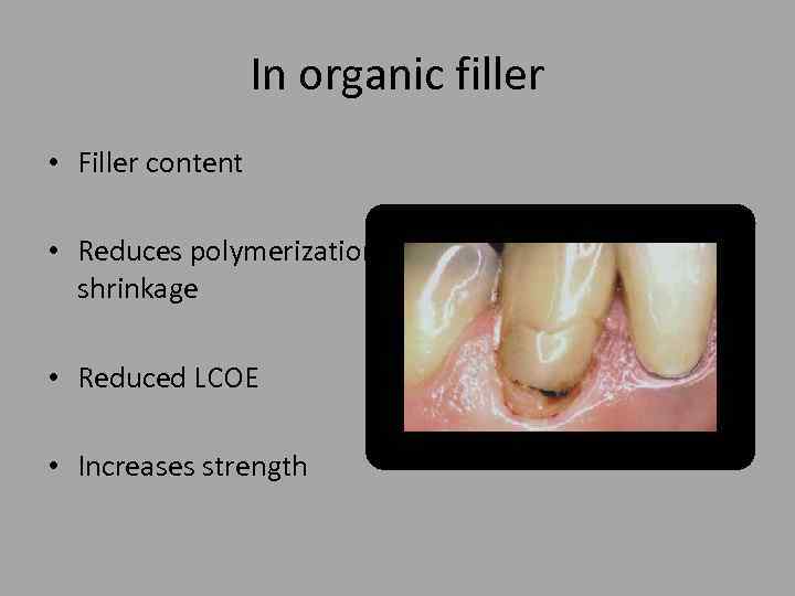 In organic filler • Filler content • Reduces polymerization shrinkage • Reduced LCOE •