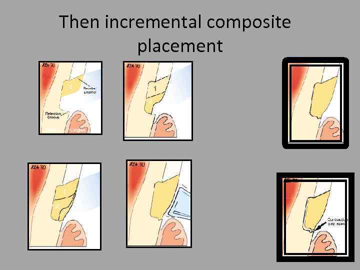 Then incremental composite placement 