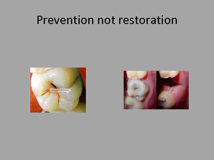 Prevention not restoration 