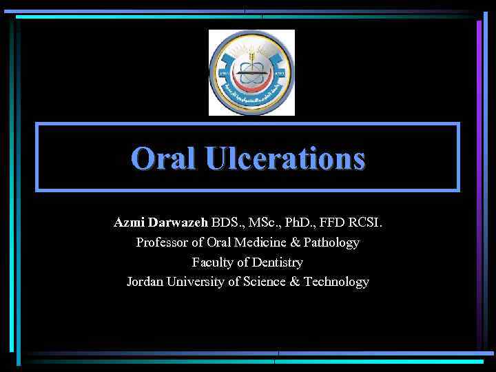 Oral Ulcerations Azmi Darwazeh BDS. , MSc. , Ph. D. , FFD RCSI. Professor