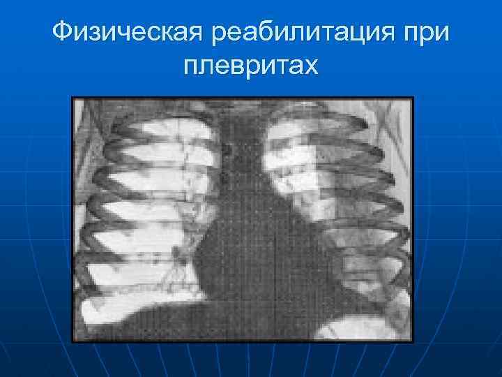 Физическая реабилитация при плевритах 