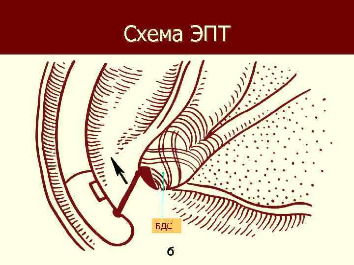 Схема ЭПТ БДС 