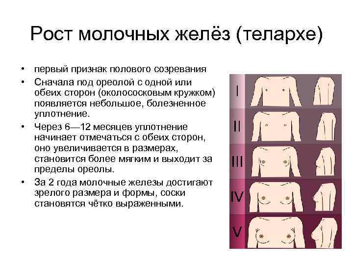 Рост молочных желёз (телархе) • первый признак полового созревания • Сначала под ореолой с