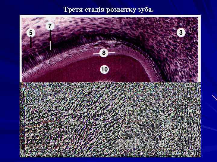 Третя стадія розвитку зуба. 