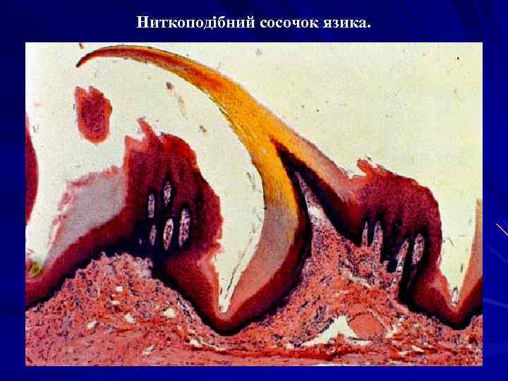 Ниткоподібний сосочок язика. 