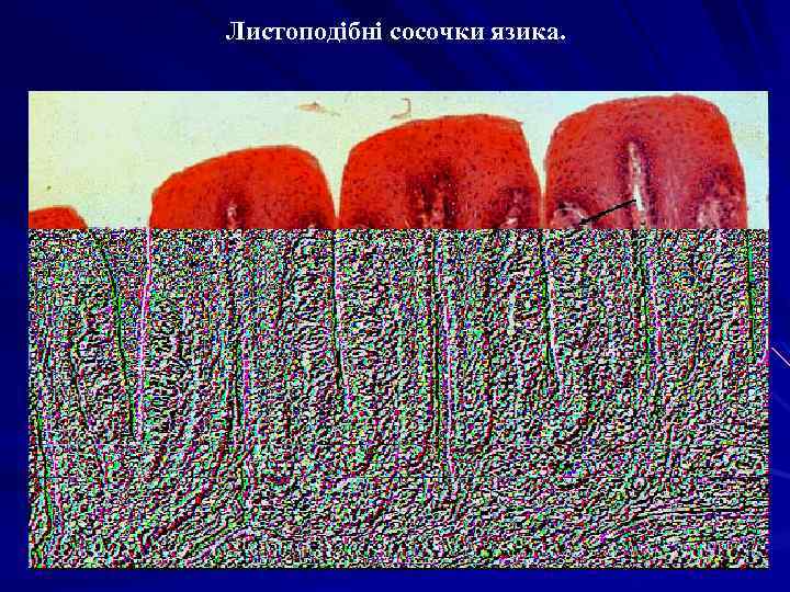 Листоподібні сосочки язика. 
