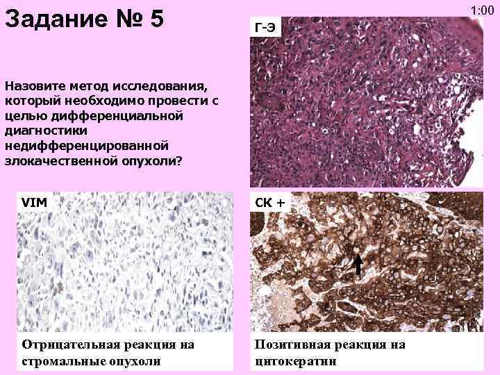 Задание № 5 1: 00 Г-Э Назовите метод исследования, который необходимо провести с целью