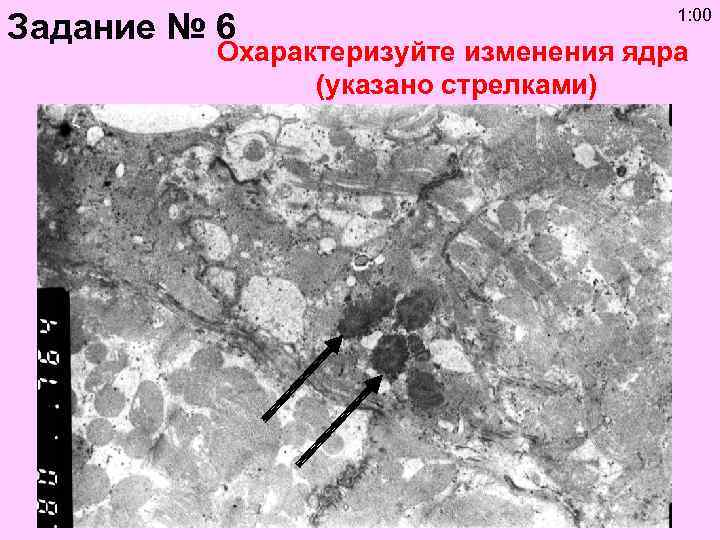 Задание № 6 1: 00 Охарактеризуйте изменения ядра (указано стрелками) 