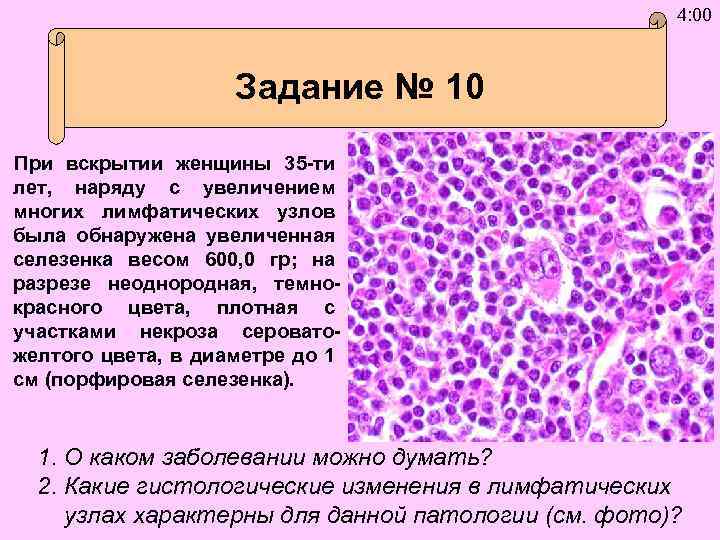 4: 00 Задание № 10 При вскрытии женщины 35 -ти лет, наряду с увеличением