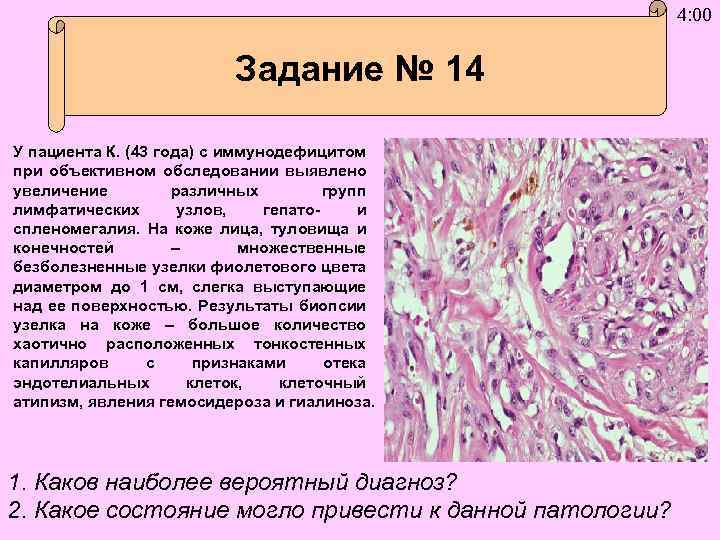 4: 00 Задание № 14 У пациента К. (43 года) с иммунодефицитом при объективном