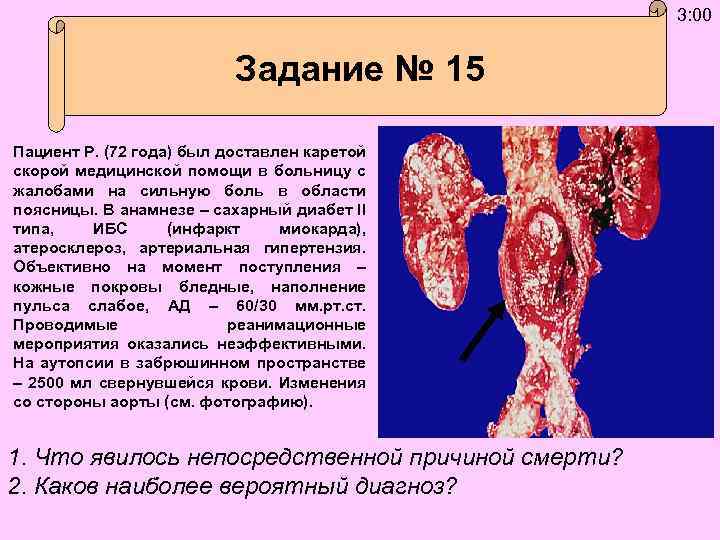 3: 00 Задание № 15 Пациент Р. (72 года) был доставлен каретой скорой медицинской