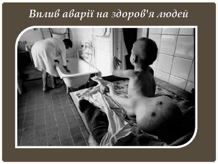Вплив аварії на здоров'я людей 