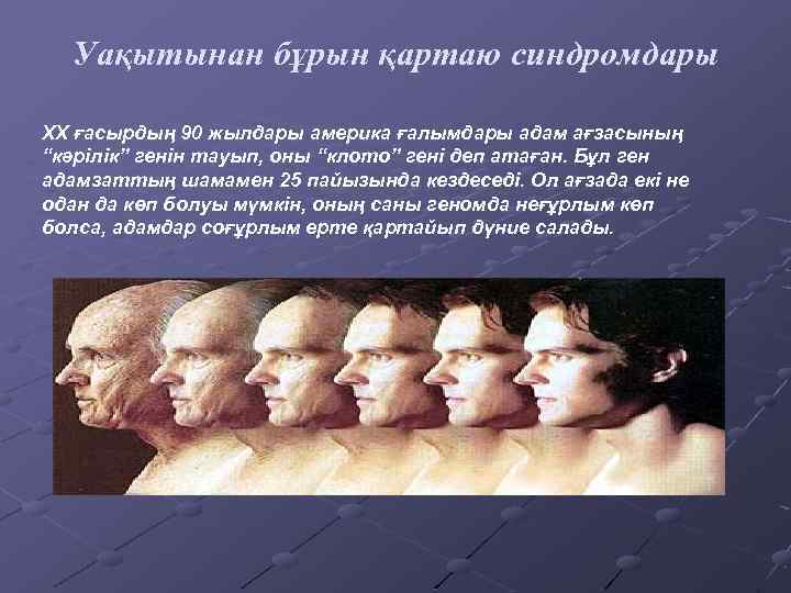 Уақытынан бұрын қартаю синдромдары ХХ ғасырдың 90 жылдары америка ғалымдары адам ағзасының “кәрілік” генін