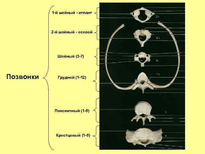 1 -й шейный - атлант 2 -й шейный - осевой Шейный (3 -7) Позвонки