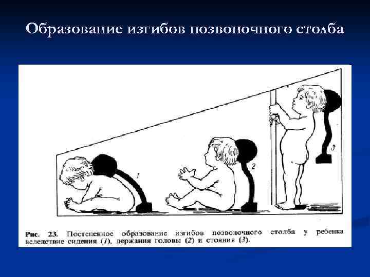 Образование изгибов позвоночного столба 