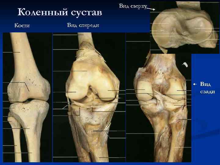 Коленный сустав Кости Вид сверху Вид спереди Вид сзади 