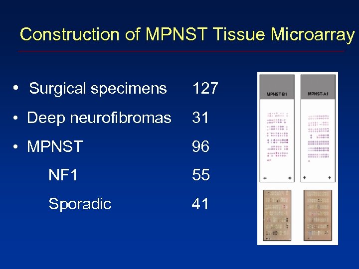 Construction of MPNST Tissue Microarray • Surgical specimens 127 • Deep neurofibromas 31 •