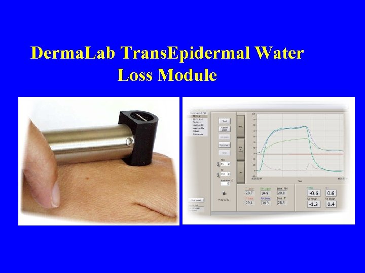 Derma. Lab Trans. Epidermal Water Loss Module 