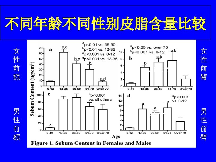 不同年龄不同性别皮脂含量比较 女 性 前 额 男 性 前 额 女性前额 男性前额 女 性 前