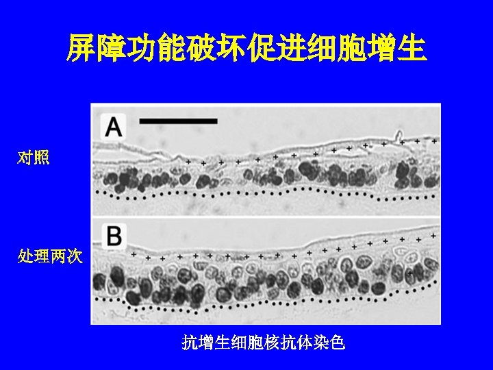 屏障功能破坏促进细胞增生 对照 处理两次 抗增生细胞核抗体染色 