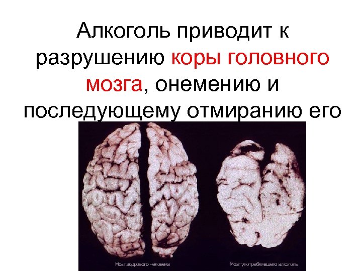 Алкоголь приводит к разрушению коры головного мозга, онемению и последующему отмиранию его участков. 
