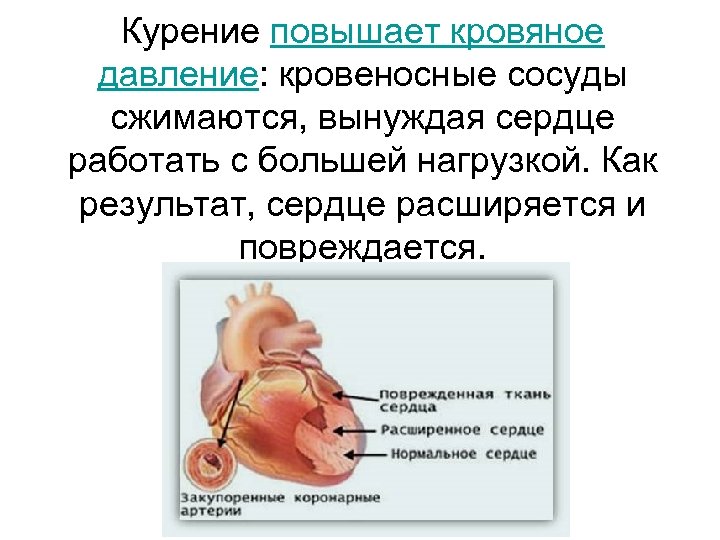 Курение повышает кровяное давление: кровеносные сосуды сжимаются, вынуждая сердце работать с большей нагрузкой. Как