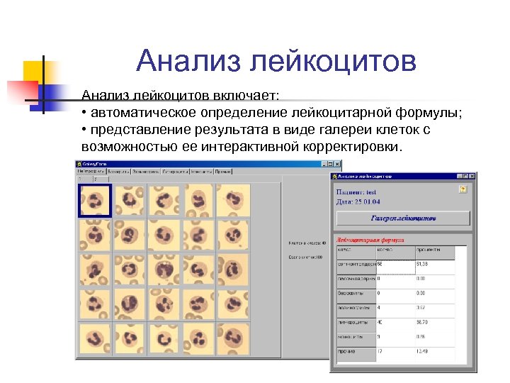 Автоматическое определение. Лабораторная диагностика лейкоцитов. Программа для подсчета лейкоцитарной формулы. Представление результатов диагностики структуры организации.. Виды автоопределения.