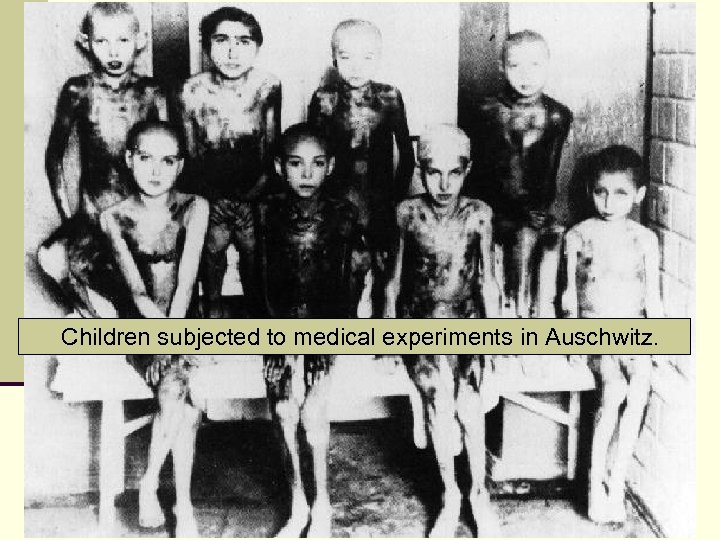 Children subjected to medical experiments in Auschwitz. 