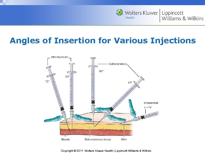 Angles of Insertion for Various Injections Copyright © 2011 Wolters Kluwer Health | Lippincott
