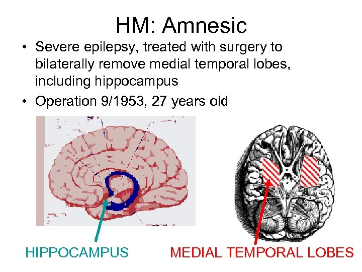 HM: Amnesic • Severe epilepsy, treated with surgery to bilaterally remove medial temporal lobes,