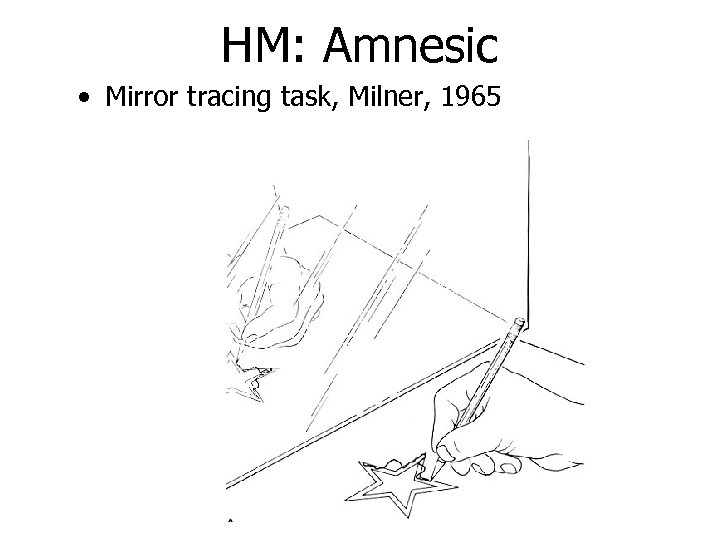 HM: Amnesic • Mirror tracing task, Milner, 1965 